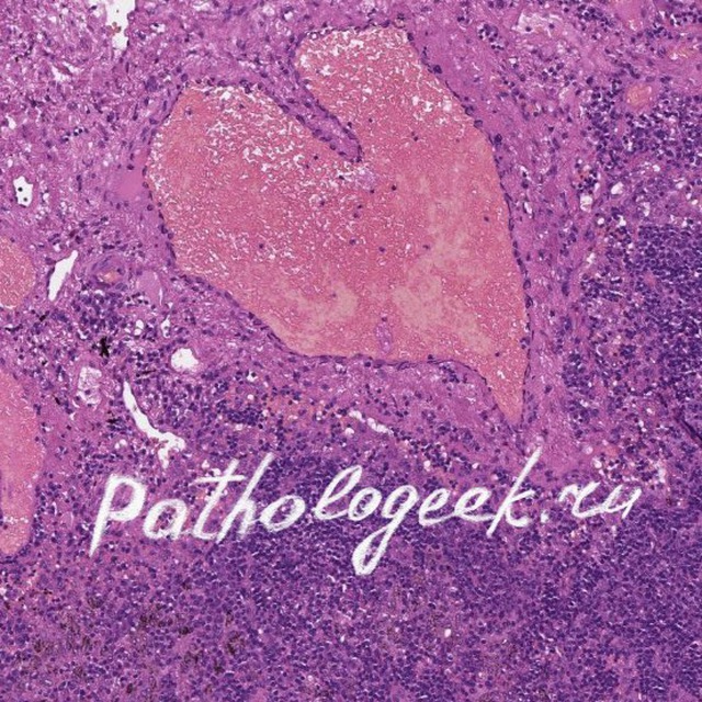 Pathologeek